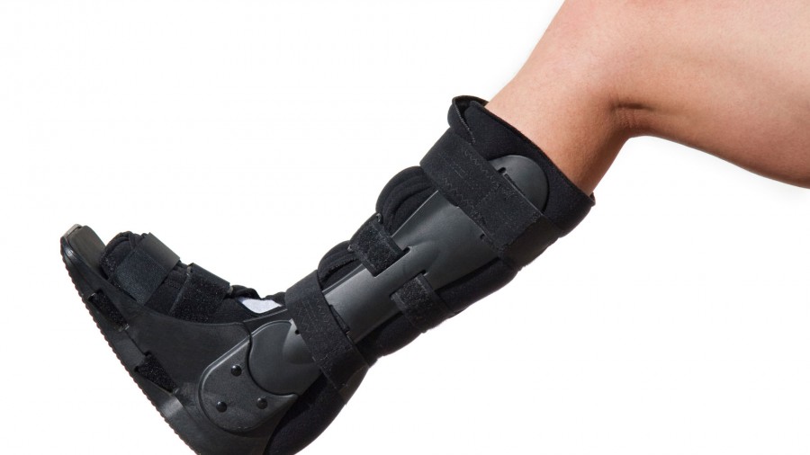 Term Leg Cast Leg casts | Don & Low Ltd